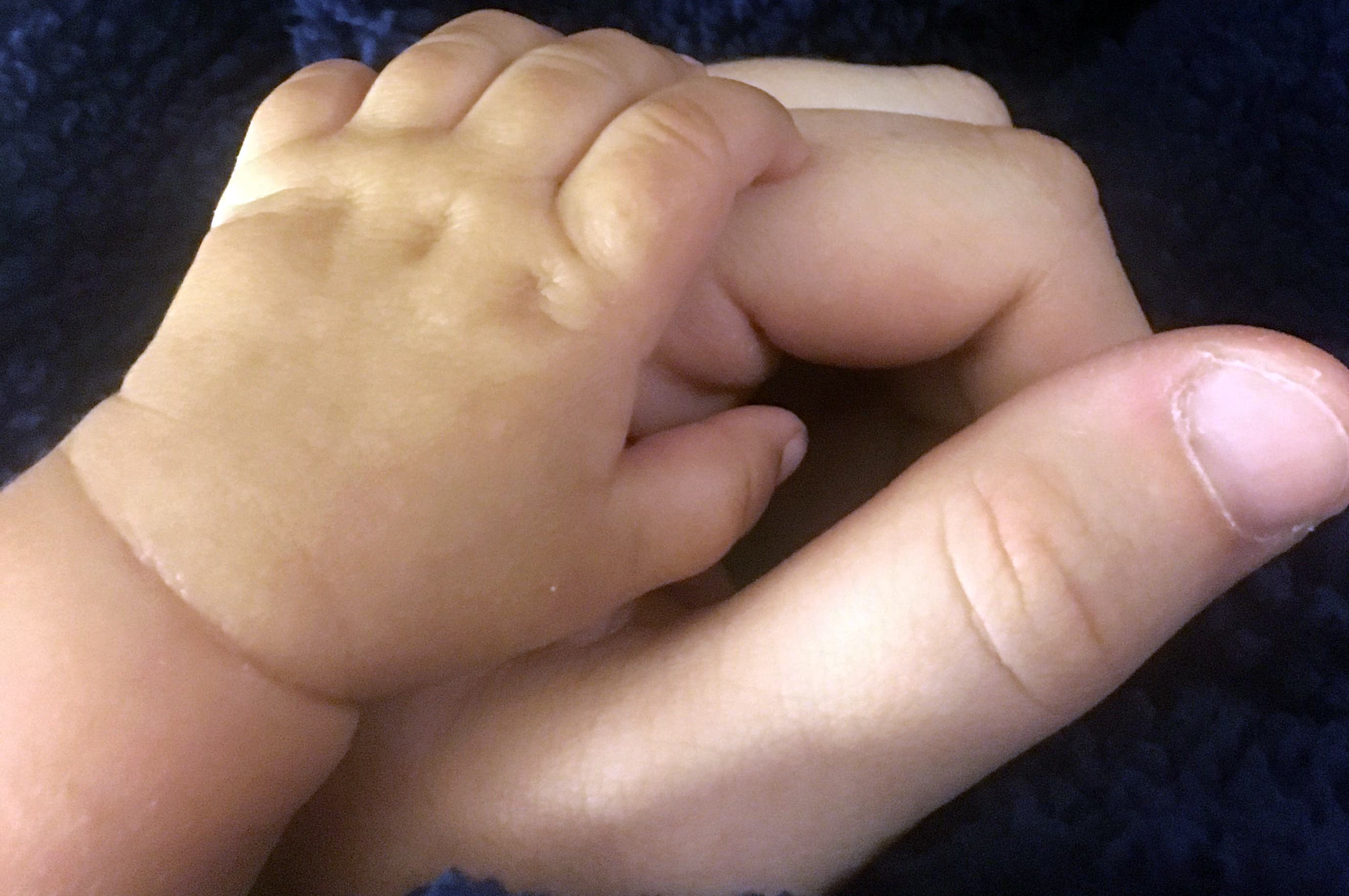 Study Reveals Higher Cancer Risk for Newborns with Heart Defects and Their Mothers