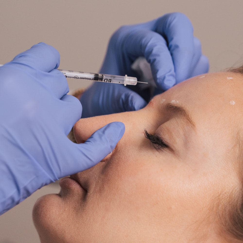 Laser Center of Marin Offers Comprehensive Botox Treatments in Corte Madera