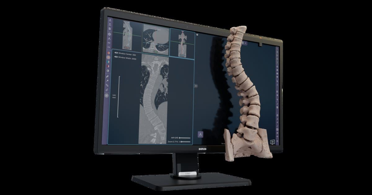 Avatar Medical Vision Earns CE Marking for Glasses-Free 3D Surgical Planning