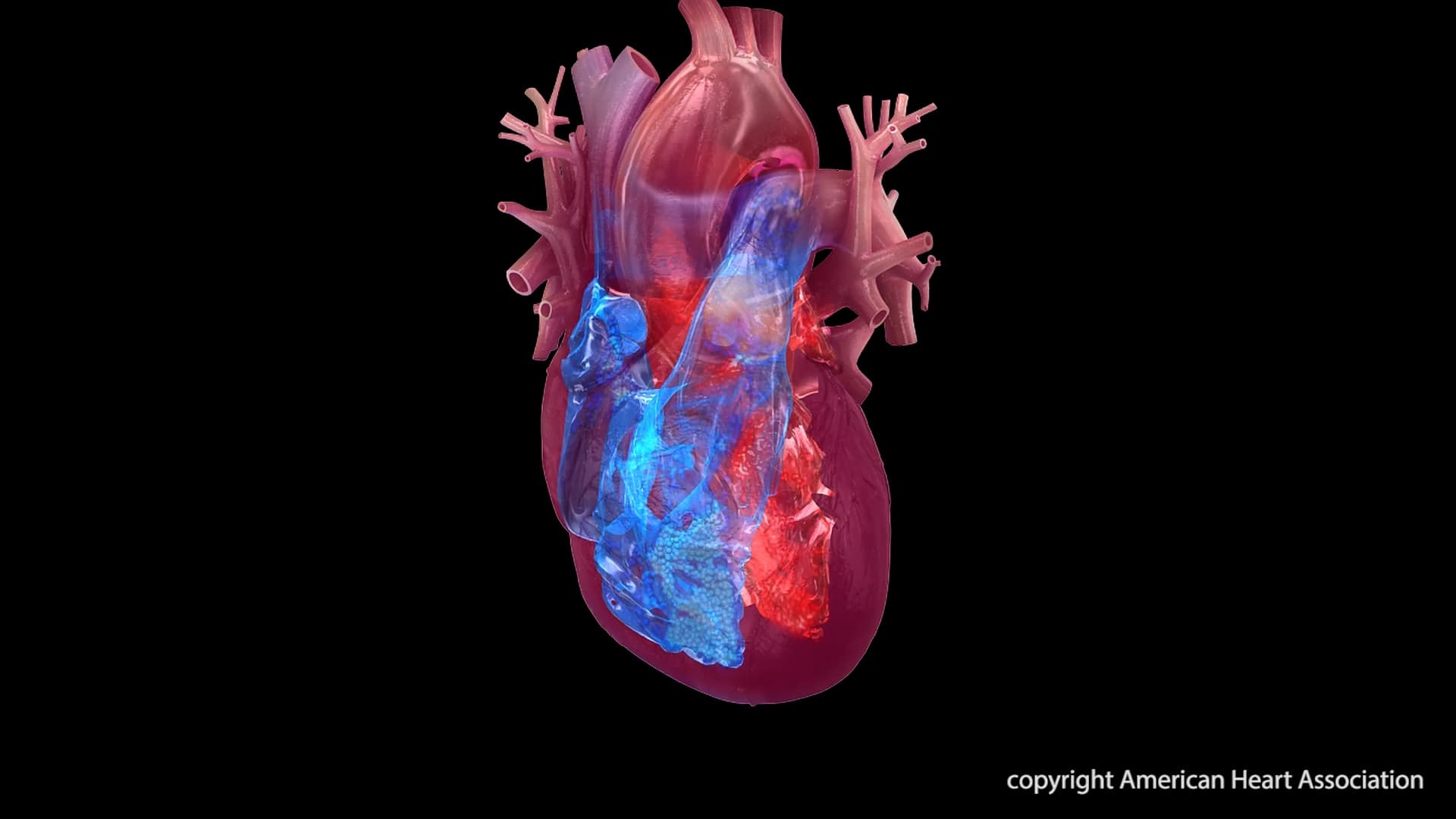 Shift in Heart Disease Mortality Highlights Advances and Challenges in Cardiovascular Health