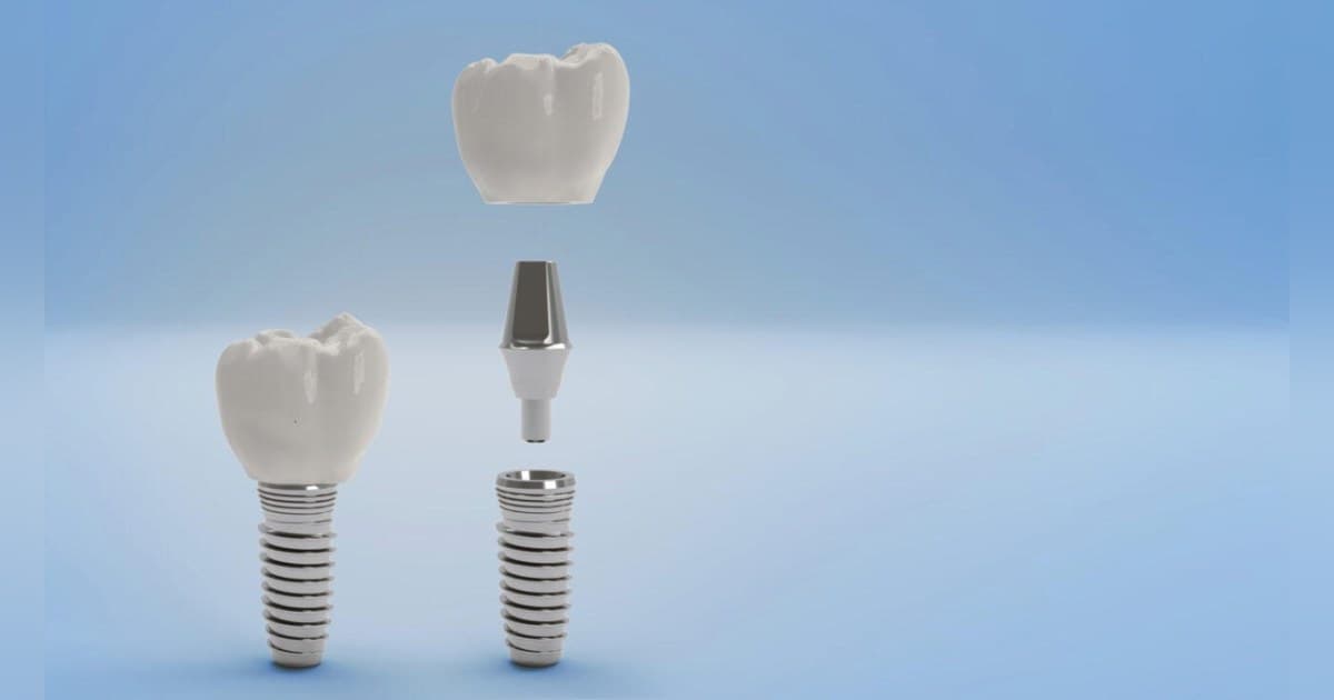Gunbarrel Dental Center Releases Clinical Guidance on Professional Teeth Whitening Options