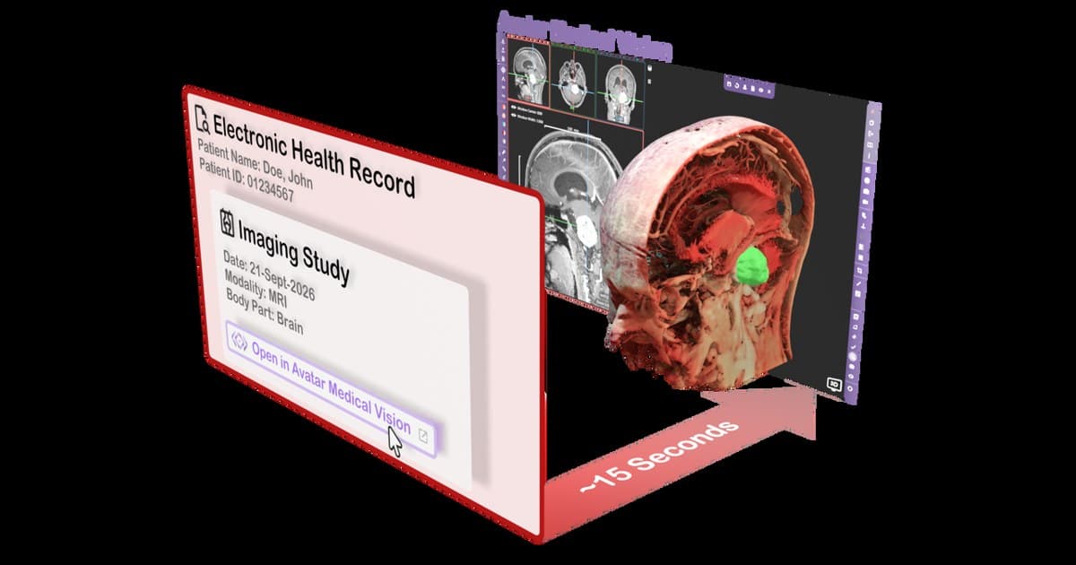 Avatar Medical Integrates Patient-Specific 3D Imaging with Epic EHR to Streamline Clinical Consultations